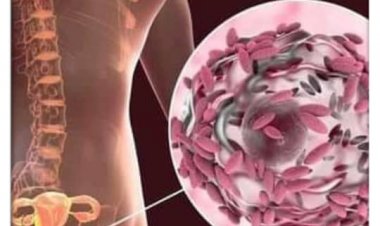 Bayani Kan Ciwon Sanyi Da Aka Fi Yadawa Ta Hanyar Jima'i 