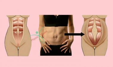 Buɗewar Murfin Ciki Bayan Haihuwa: Sababi,  Da Maganinsa