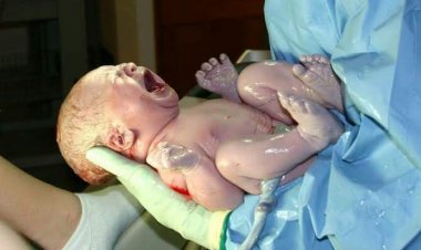 Jaririn ya yi kuka? Me ye makomar rashin kukan nan-take?