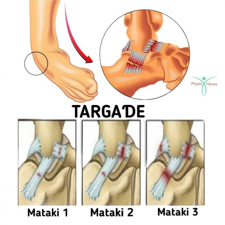 "Gyaran Targaɗe" Ko ƙara Targaɗe?