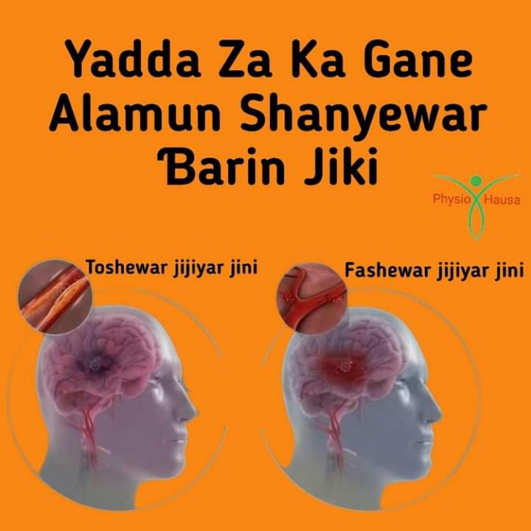 Yadda za ka gane alamun shanyewar ɓarin jiki da abin da ya kamata ka yi