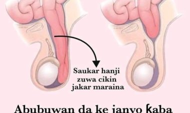 Ƙaba: Abin da ya kamata ka sani game da ƙaba da abubuwan da ke janyo ta