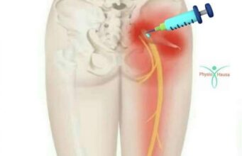 Sabuwar Cuta Ta Bulla a Sokoto Har Ta Kama Mutum 71