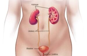 Alamomi 7 da za ku gane ƙoda ta fara samun matsala